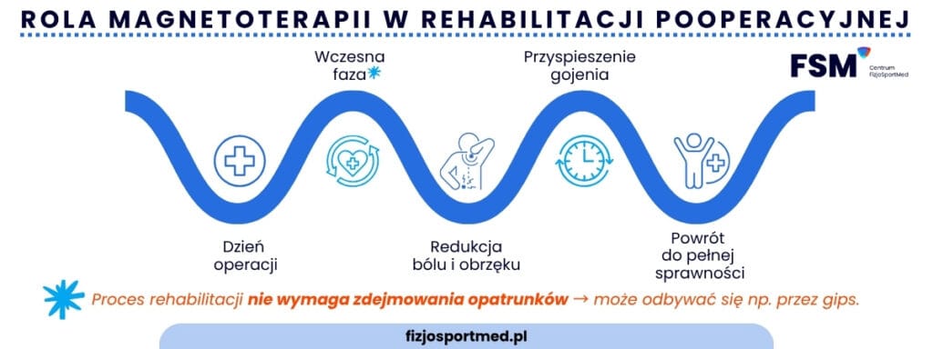Infografika B — „Magnetoterapia Po Operacji — Os Rehabilitacji