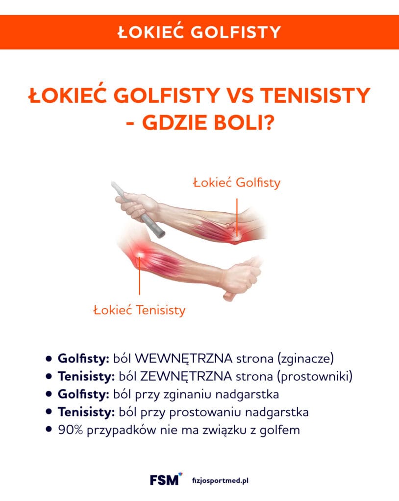 Łokieć golfisty – objawy, przyczyny i skuteczne metody leczenia 1 Lokiec Golfisty