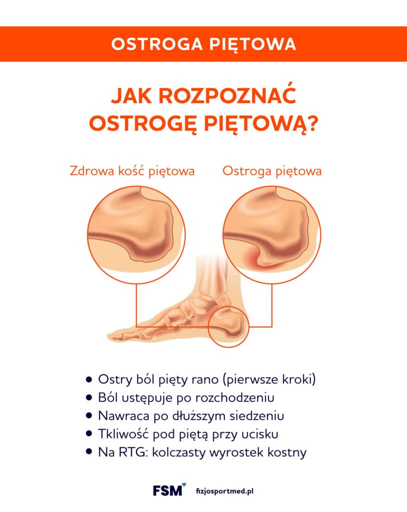 Ostroga Pietowa