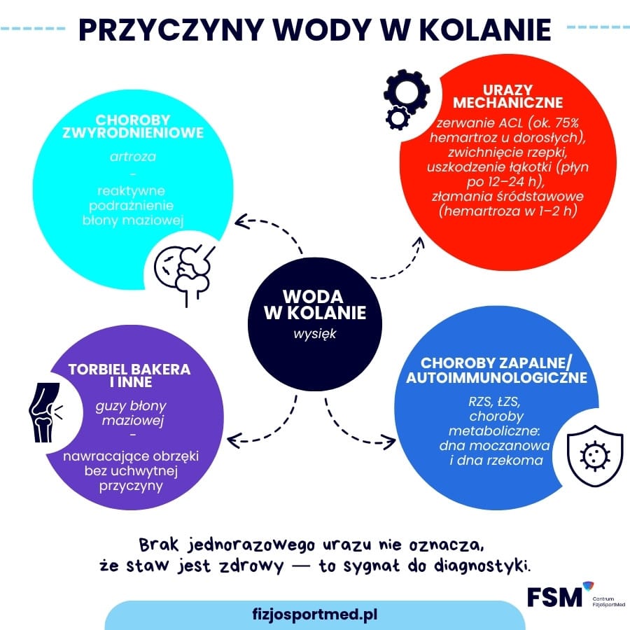 Przyczyny wody w kolanie — urazy, choroby i diagnostyka 1 Przyczyny Wody W Kolanie — Mapa